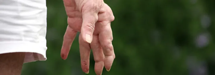 A close up image of a persons hand.